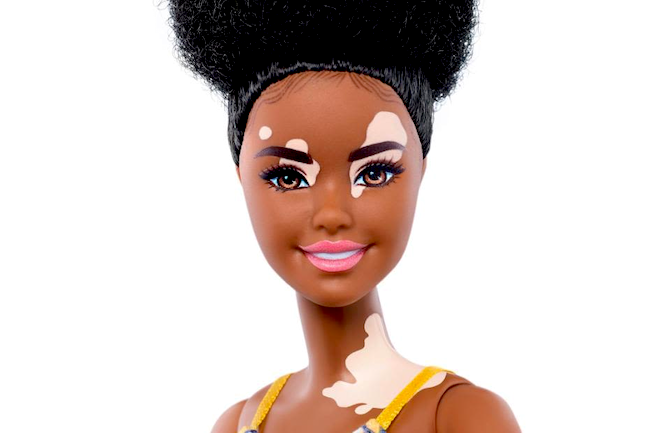 Barbie vitíligo Día Niño Publimark